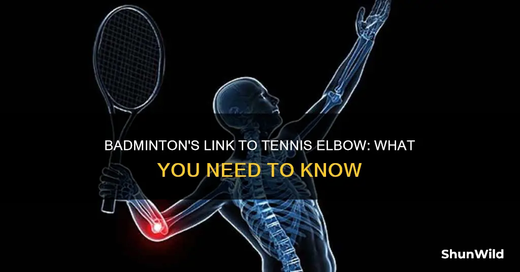 can badminton cause tennis elbow