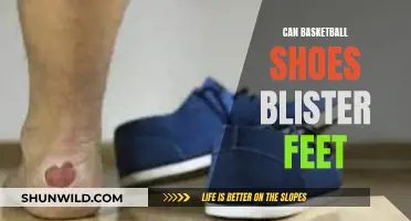 Basketball Shoes: Blister-Prone Feet's Bane?