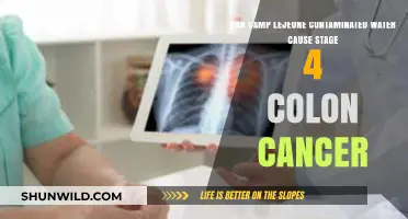 Camp Lejeune Contaminated Water: Potential Link to Stage 4 Colon Cancer?