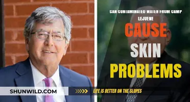 Camp Lejeune's Contaminated Water: Uncovering Links to Skin Issues