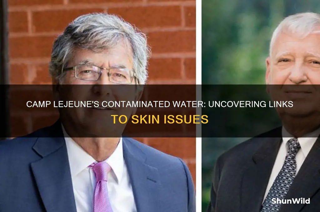can contaminated water from camp lejuene cause skin problems