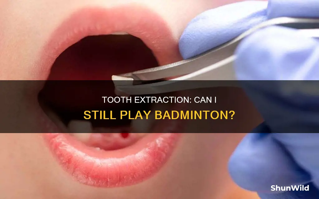 can i play badminton after tooth extraction