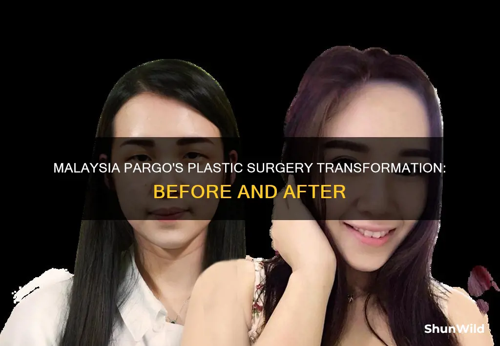 did malaysia from basketball wives have plastic surgery