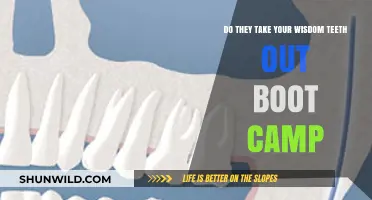 Wisdom Teeth Extraction at Boot Camp: What to Expect