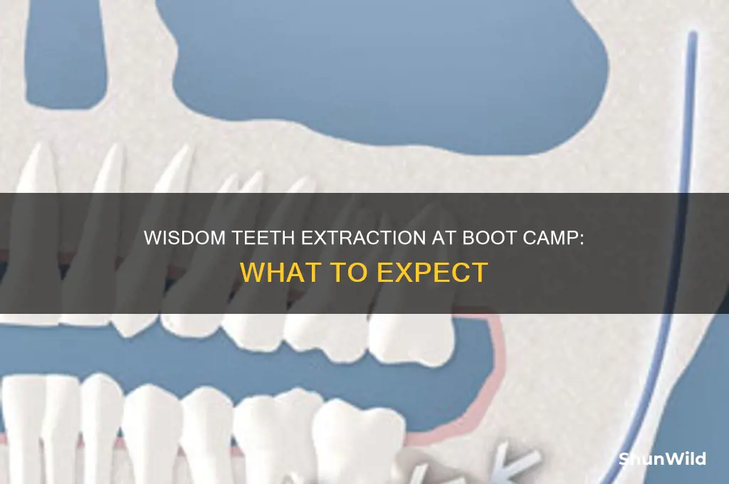 do they take your wisdom teeth out boot camp