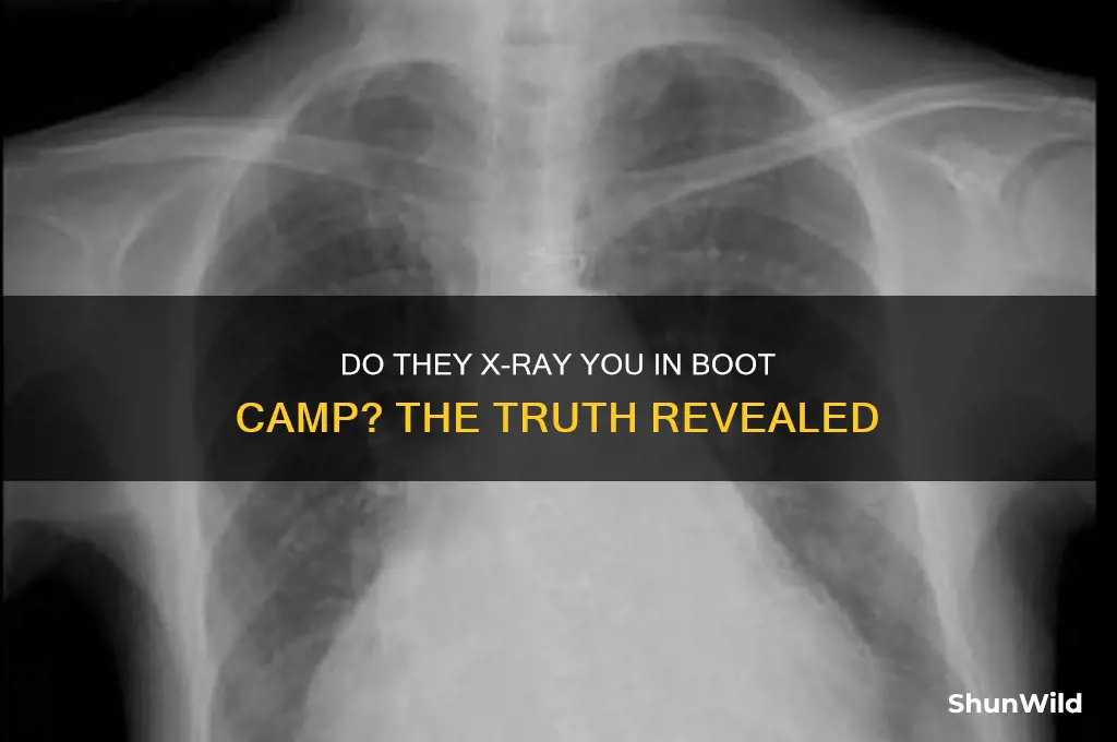 do they x ray you in boot camp