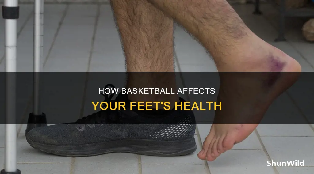 does basketball mess up your feet