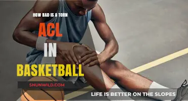 ACL Tears: A Basketball Player's Nightmare