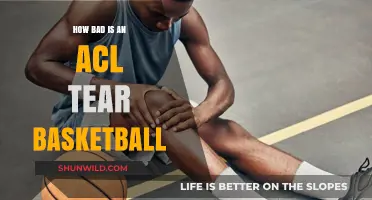 ACL Tears: A Basketball Player's Nightmare