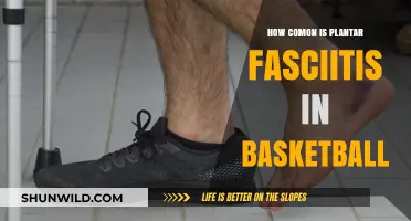 Plantar Fasciitis: A Common Ailment for Basketball Players