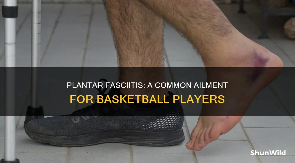 how comon is plantar fasciitis in basketball