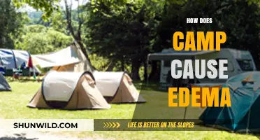 Understanding Edema: How Camping Activities Lead to Swelling and Prevention Tips