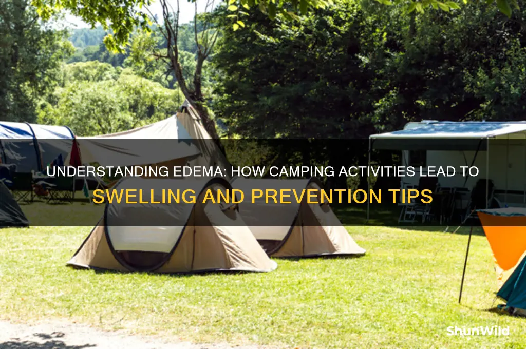 how does camp cause edema