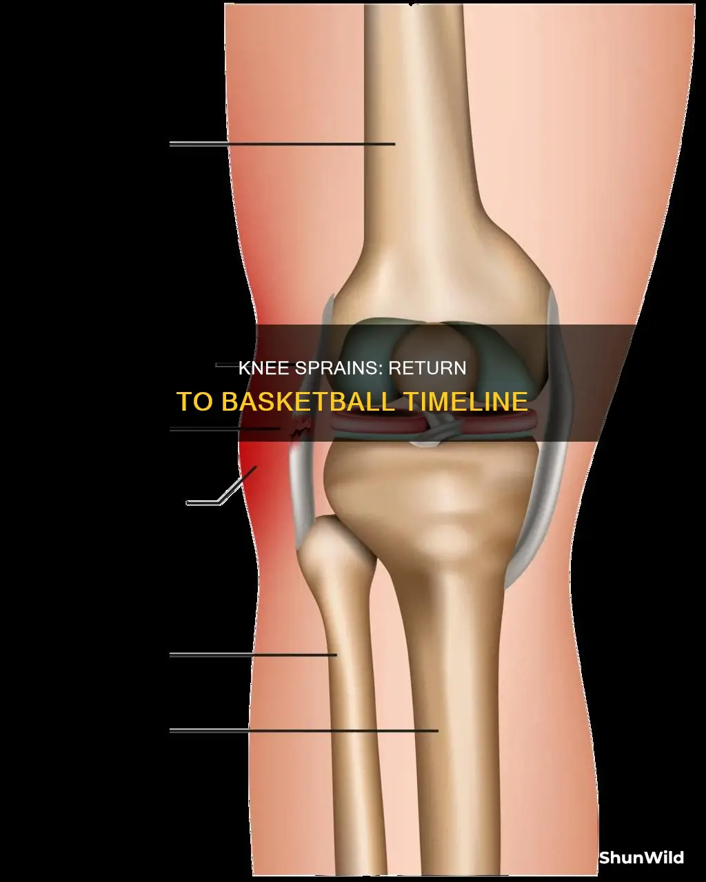 how long are you out for a sprained knee basketball