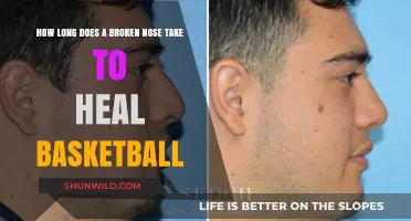 Healing a Broken Nose: Return to the Basketball Court