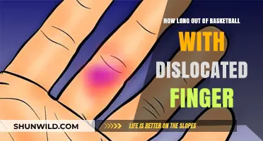 Dislocated Finger: Return to Basketball Timeline