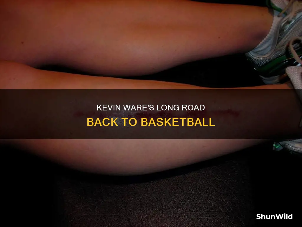 how long was kevin ware out of basketball