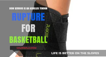 Achilles Rupture: A Career-Ending Injury for Basketball Players?