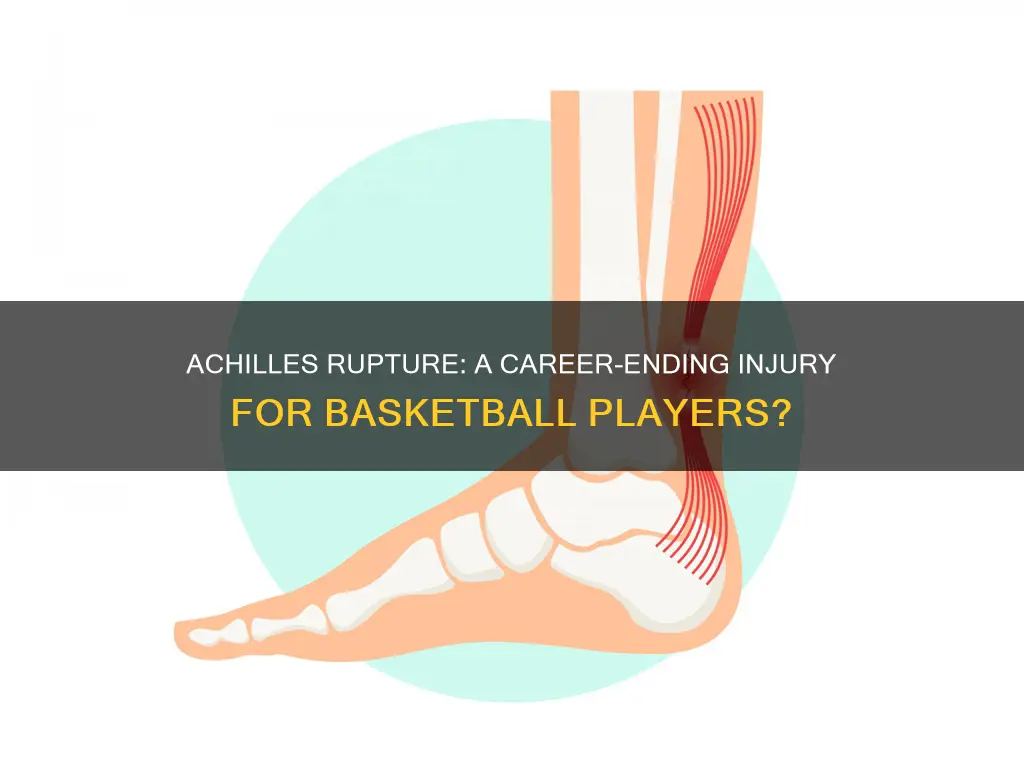 how serious is an achilles tendon rupture for basketball
