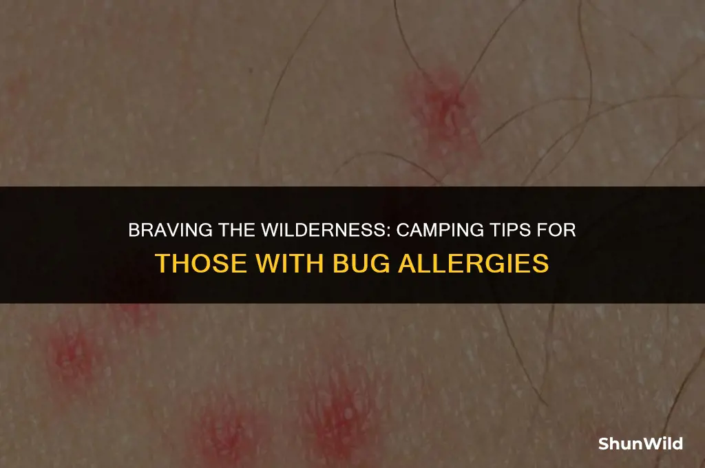 how to camp with bug allergies