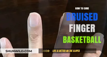 Heal Your Bruised Finger, Get Back to Basketball