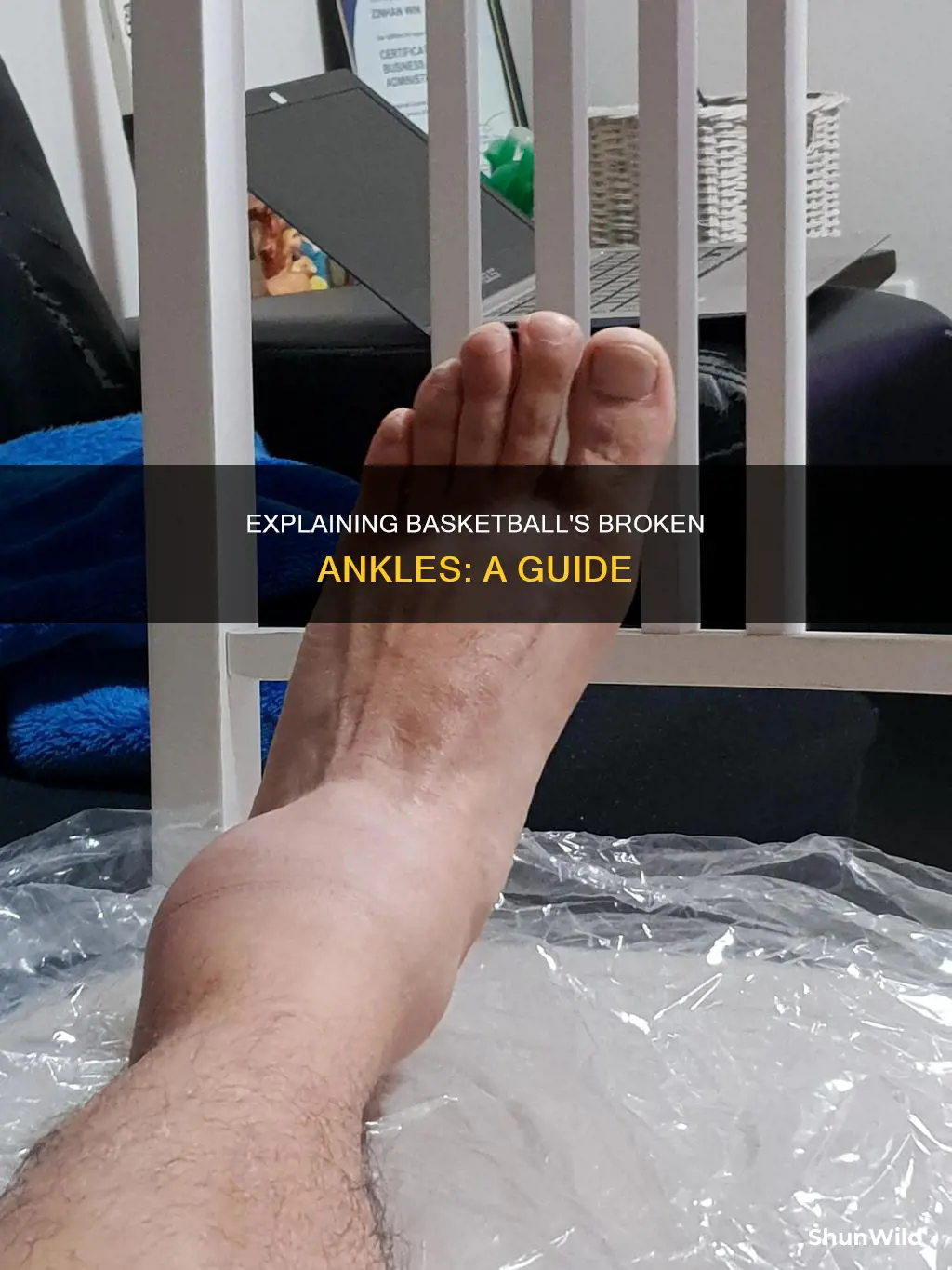 how to explain a broken ankle in basketball