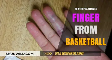 Fixing a Jammed Finger: Basketball Recovery Tips