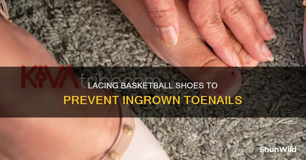 how to lace basketball shoes for ingrown toenail