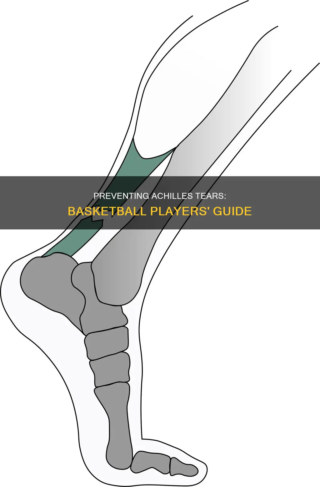 how to prevent achilles tear basketball