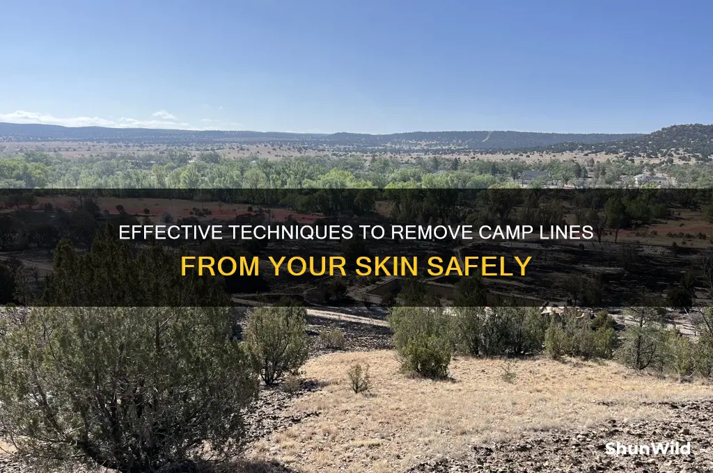 how to remove camp line