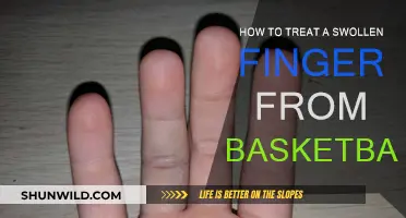 Treating Swollen Fingers: Basketball Recovery Tips