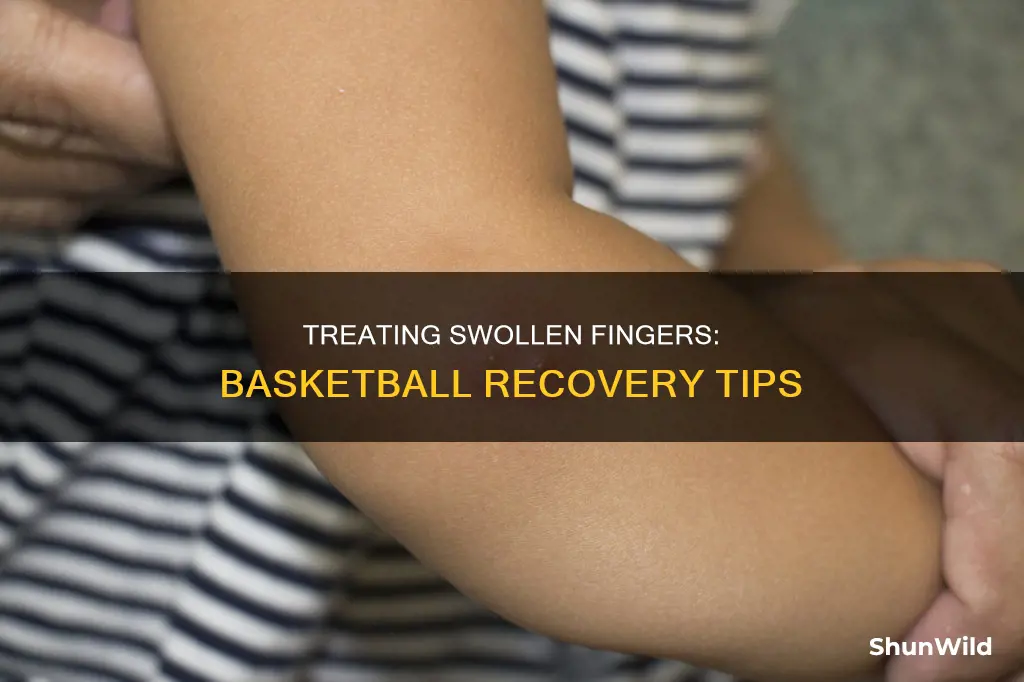 how to treat a swollen finger from basketball