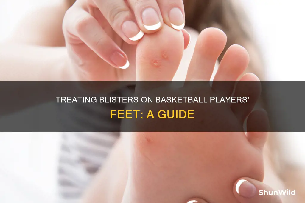 how to treat blisters on feet from basketball