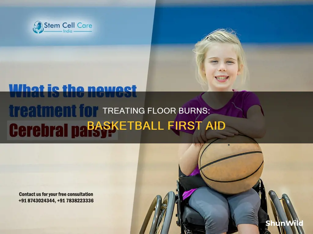 how to treat floor burns from basketball