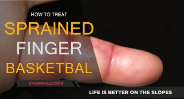 Treating a Sprained Finger: Basketball Edition