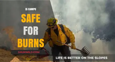 Is Campo Safe for Burns? Exploring Its Effectiveness and Safety