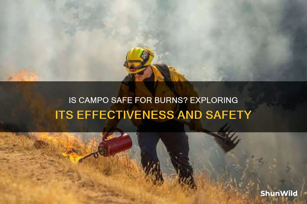 is campo safe for burns