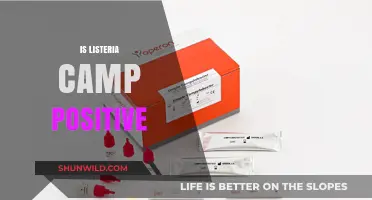 Understanding Listeria Camp Test Results: Positive Implications Explained