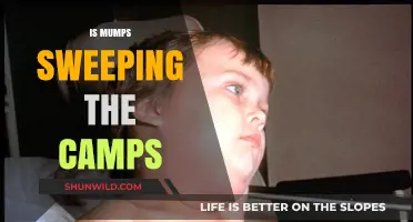 Mumps Outbreak in Camps: Causes, Risks, and Prevention Measures