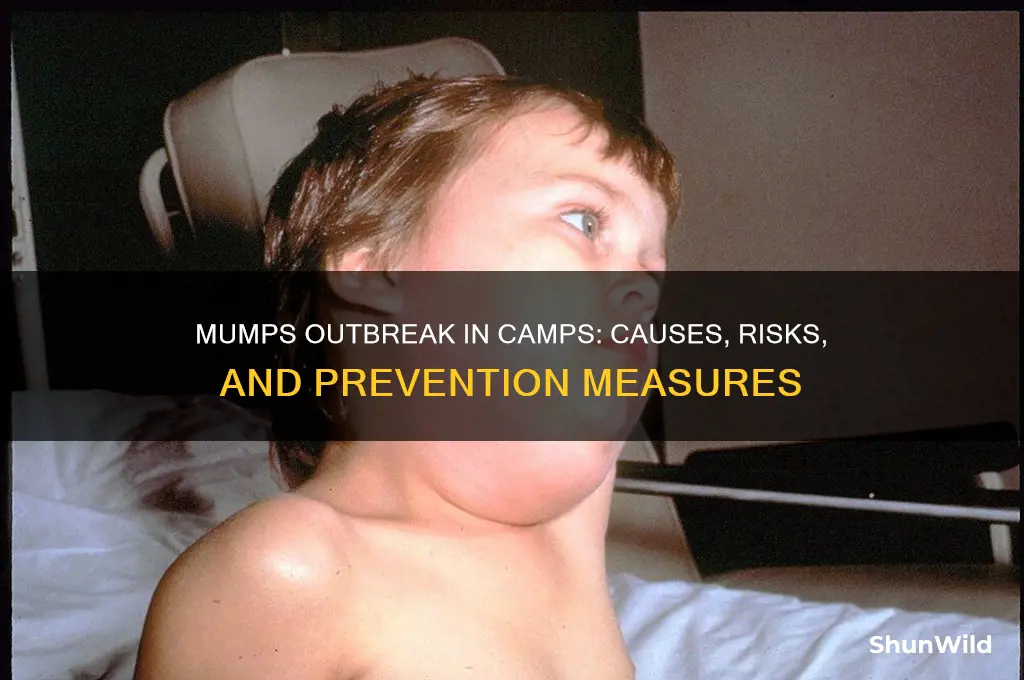 is mumps sweeping the camps