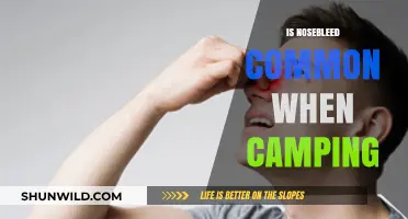 Nosebleeds While Camping: Common Causes and Prevention Tips
