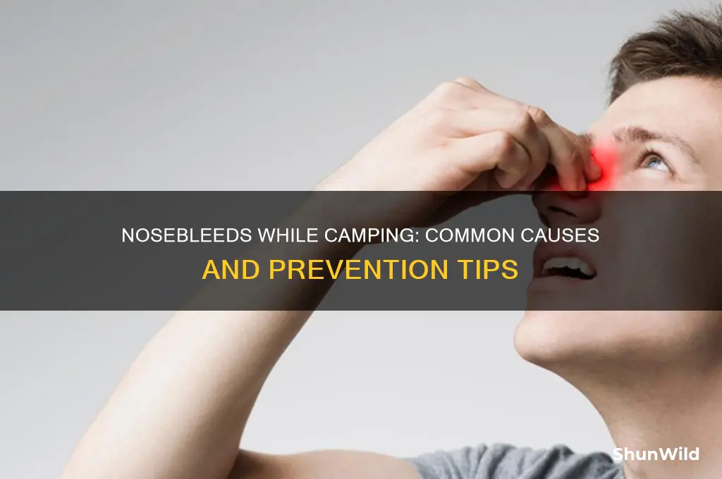 is nosebleed common when camping