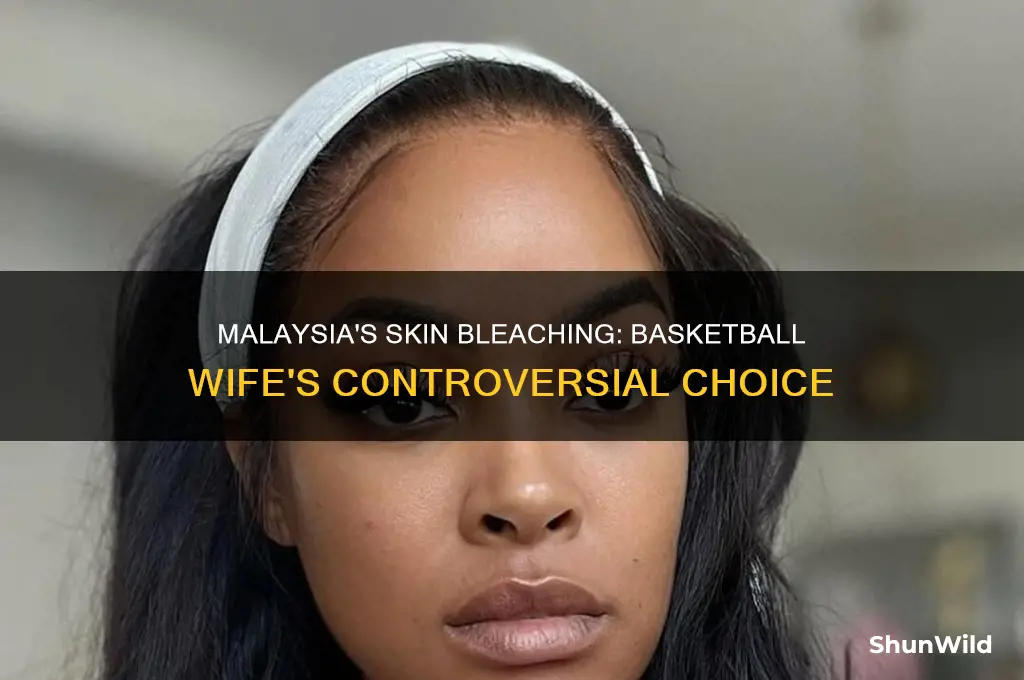 is the basketball wife malaysia bleaching her skin