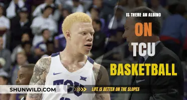 TCU Basketball's Star: An Albino Athlete?