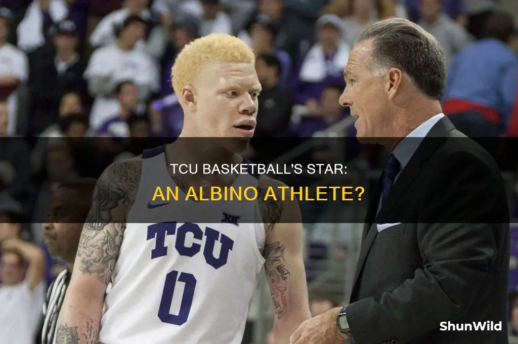 is there an albino on tcu basketball