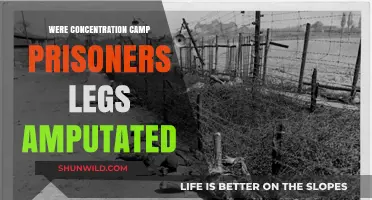 Concentration Camp Medical Atrocities: Leg Amputations and Prisoner Suffering