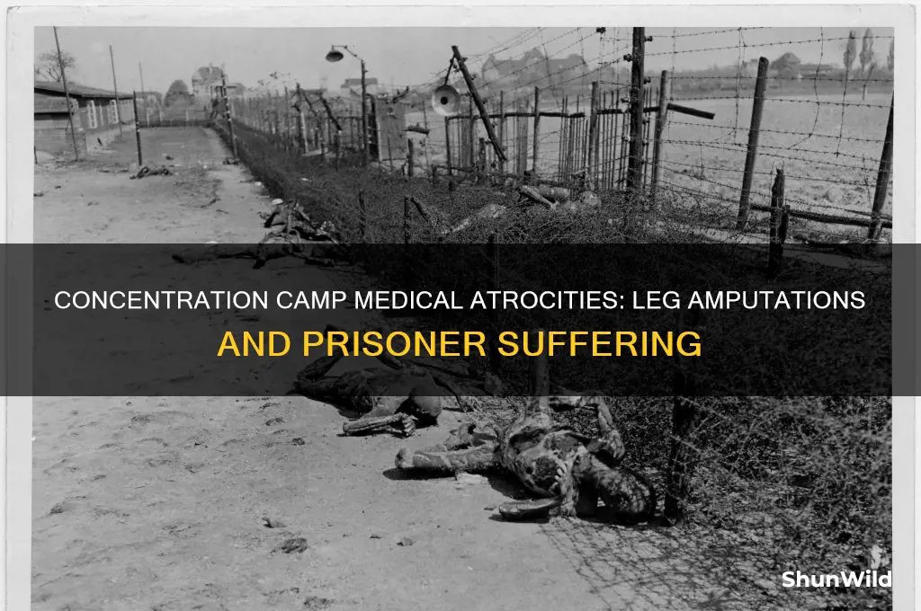 were concentration camp prisoners legs amputated