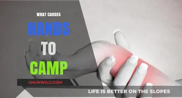 Understanding Hand Cramping: Causes, Prevention, and Effective Relief Strategies