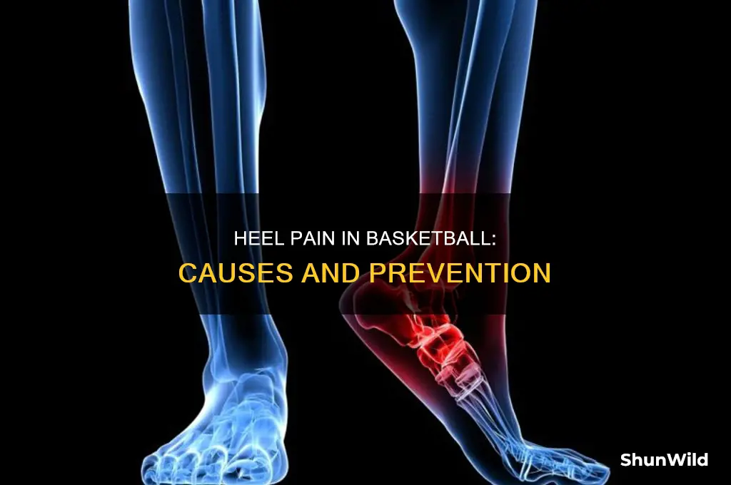 what causes heel pain basketball