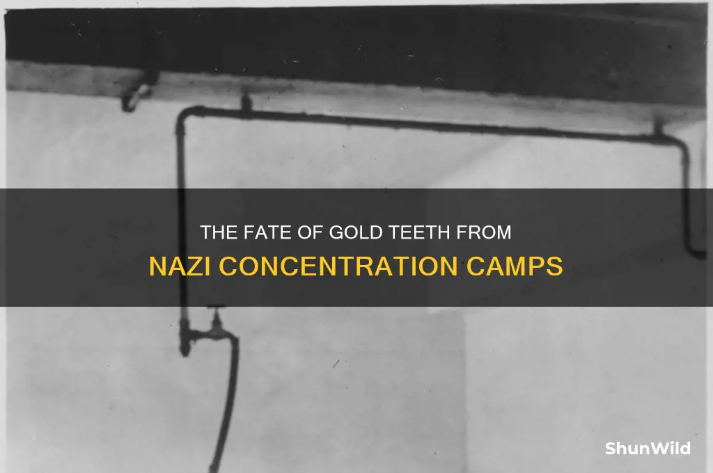 what happened to the concentration camp gold teeth